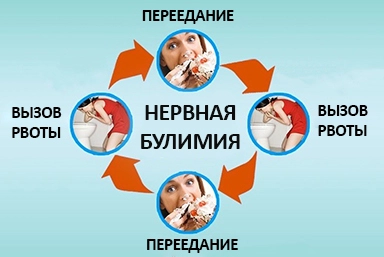 Лечение булимии в городе Хилок